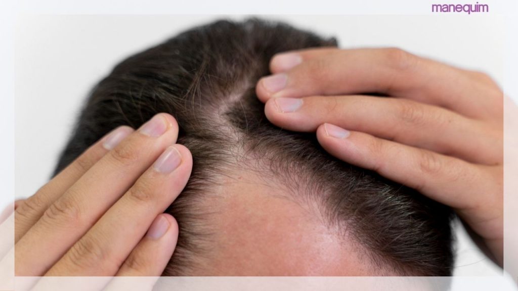 Efeito ''build up'': aspecto sujo e pesado dos fios afeta a saúde dos cabelos, mas tem reversão