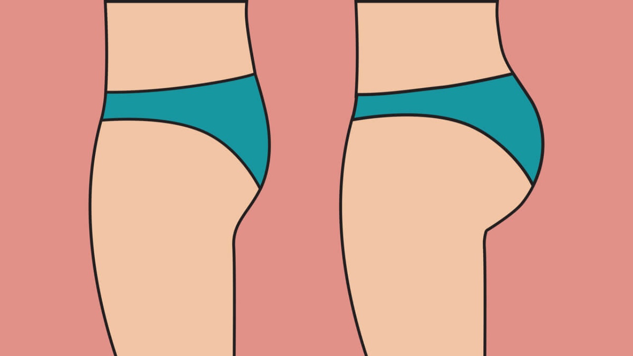 Pronto para o verão! 4 procedimentos estéticos para empinar o bumbum