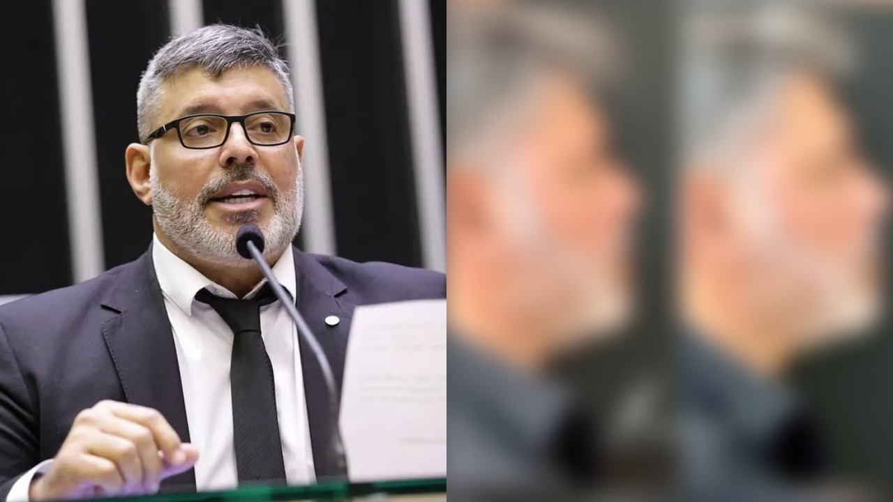 NOVO ROSTO! Alexandre Frota realiza harmonização facial